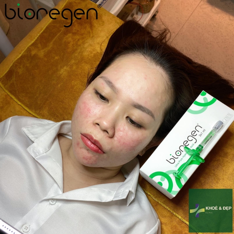 Đối tác chính cung cấp Bioregen cho các bệnh viện tại Đà Nẵng