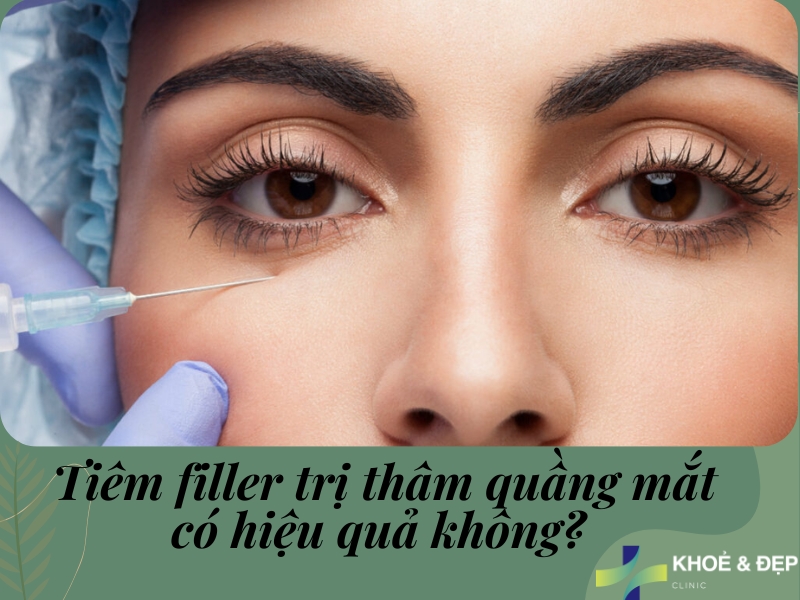 Tiêm thâm quầng mắt có hiệu quả không? Tiêm thâm quầng mắt có hiệu quả không?