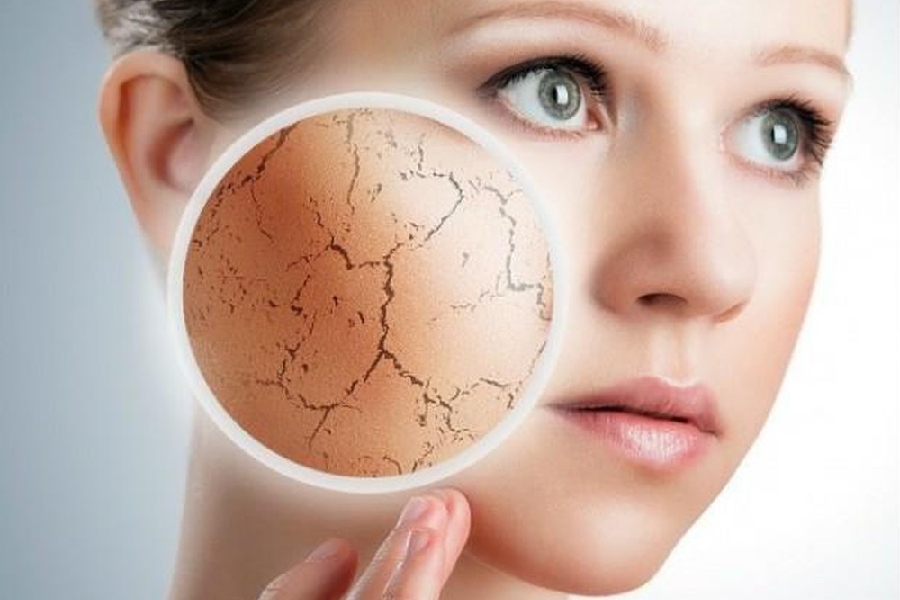 Xác định đúng loại da và tình trạng da Xác định đúng loại da và tình trạng da