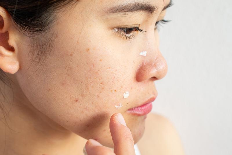 Sản phẩm đặc trị Sản phẩm đặc trị